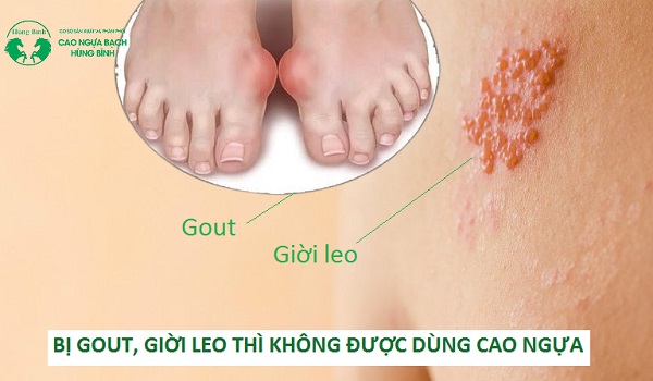 Những ai không nên ăn cao ngựa?