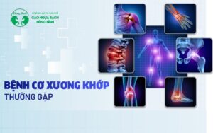 Bệnh cơ xương khớp: Các loại, nguyên nhân, triệu chứng, điều trị