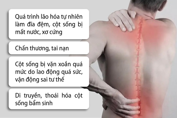 Thoát vị đĩa đệm
