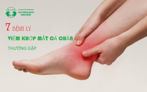 7 Bệnh lý viêm khớp hàng đầu gây tình trạng đau mắt cá chân