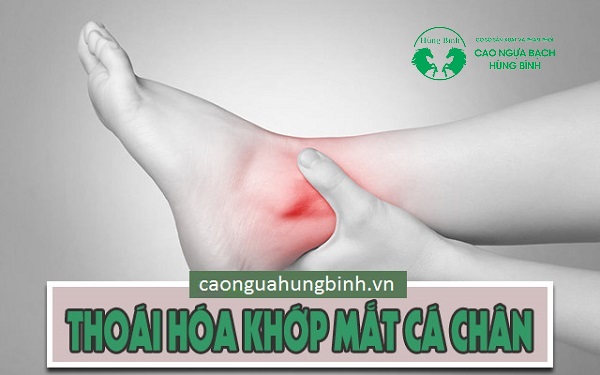 Đau mắt cá chân do thoái hóa khớp