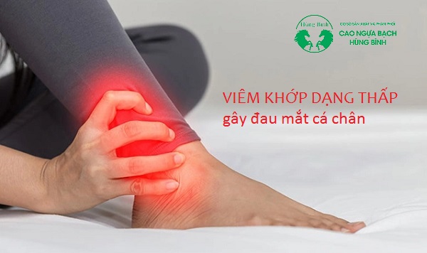 Viêm khớp dạng thấp