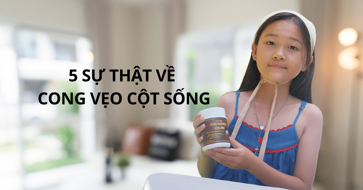 5 Sự Thật Về Cong Vẹo Cột Sống Và Cách Phòng Ngừa